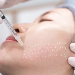 Mesotherapie